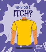 Book cover of WHY DO I ITCH