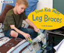 Book cover of SOME KIDS WEAR LEG BRACES