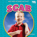 Book cover of SCAB - WHY DOES MY BODY DO THAT